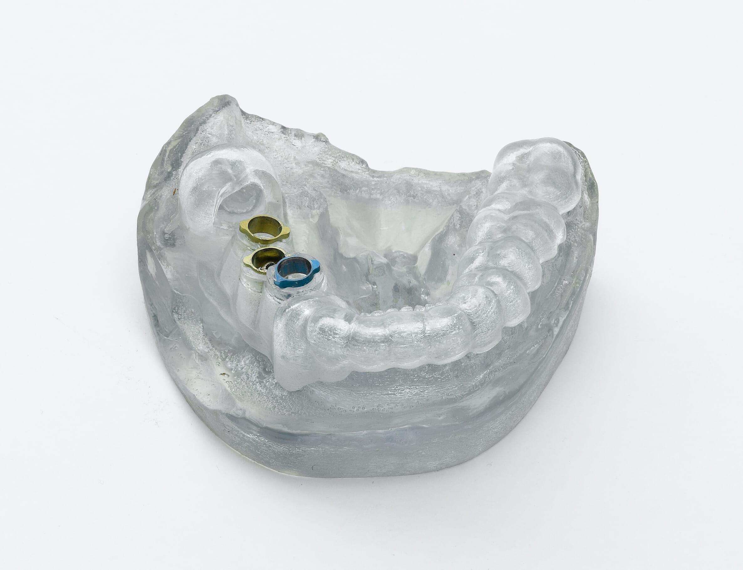 3D print surgical guide