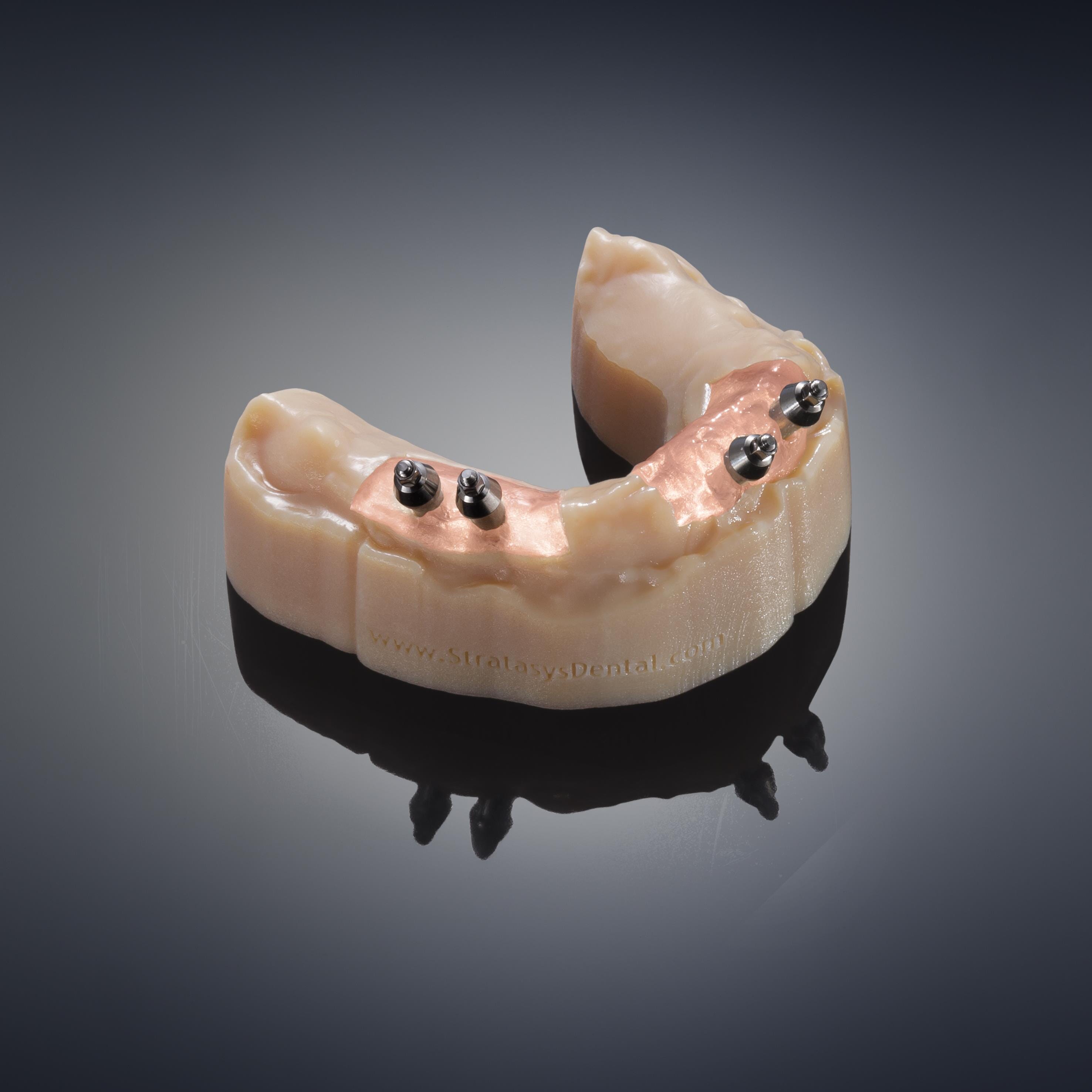 Dental Prototype gloss coloured