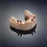 Dental Prototype gloss coloured