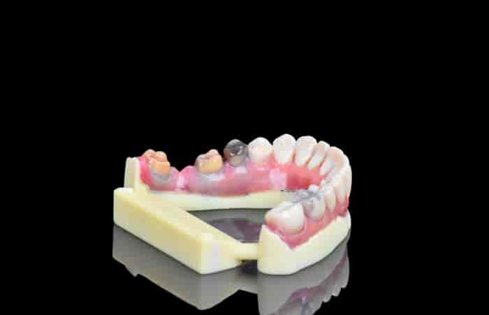 Stratasys J720 teeth model